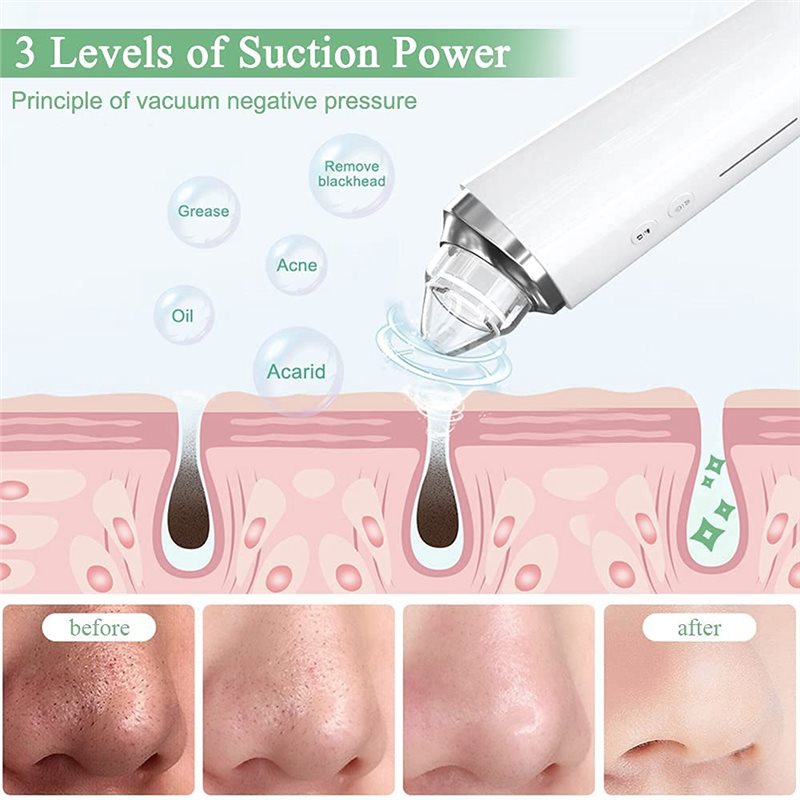 【FITTING】Blackhead Remover Por - Home Cinema Hd ulasan dan harga
